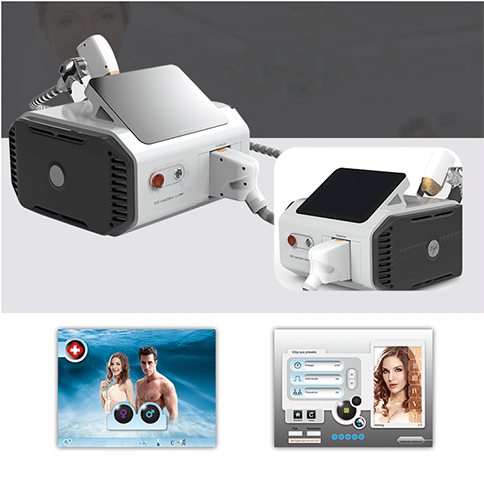 hair removal laser