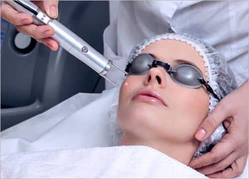 yag laser machine