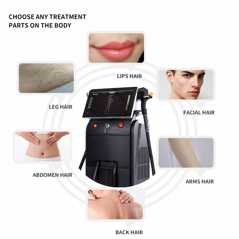 hair removal machine